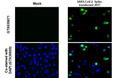 Anti-SARS-CoV-2 (COVID-19) Spike S1 antibody [HL134] used in IHC-P (cell pellet) (IHC-P (cell pellet)). GTX635671