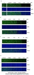 Anti-SARS-CoV-2 (COVID-19) Nucleocapsid antibody [HL249] used in Immunocytochemistry/ Immunofluorescence (ICC/IF). GTX635678