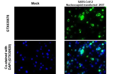 Anti-SARS-CoV-2 (COVID-19) Nucleocapsid antibody [HL249] used in IHC-P (cell pellet) (IHC-P (cell pellet)). GTX635678