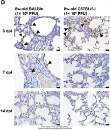 Anti-SARS-CoV-2 (COVID-19) Nucleocapsid antibody [HL344] used in IHC (Paraffin sections) (IHC-P). GTX635679