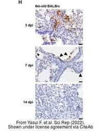 Anti-SARS-CoV-2 (COVID-19) Nucleocapsid antibody [HL344] used in IHC (Paraffin sections) (IHC-P). GTX635679