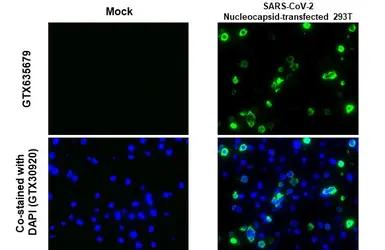 Anti-SARS-CoV-2 (COVID-19) Nucleocapsid antibody [HL344] used in IHC-P (cell pellet) (IHC-P (cell pellet)). GTX635679