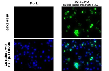 Anti-SARS-CoV-2 (COVID-19) Nucleocapsid antibody [HL5410] used in IHC-P (cell pellet) (IHC-P (cell pellet)). GTX635685