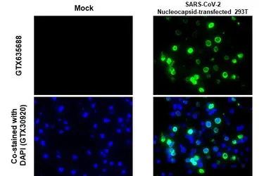 Anti-SARS-CoV-2 (COVID-19) Nucleocapsid antibody [HL455] used in IHC-P (cell pellet) (IHC-P (cell pellet)). GTX635688