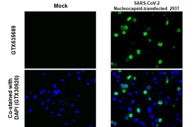 Anti-SARS-CoV-2 (COVID-19) Nucleocapsid antibody [HL5511] used in IHC-P (cell pellet) (IHC-P (cell pellet)). GTX635689