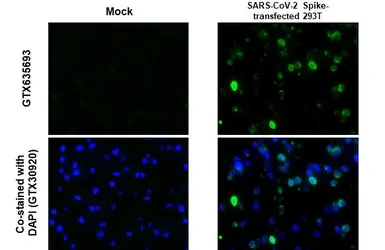 Anti-SARS-CoV-2 (COVID-19) Spike S2 antibody [HL237] used in IHC-P (cell pellet) (IHC-P (cell pellet)). GTX635693