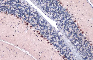 Anti-Gli1 antibody [GT249] used in IHC (Paraffin sections) (IHC-P). GTX635705