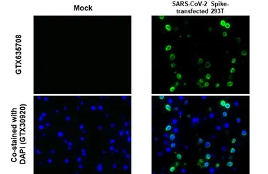 Anti-SARS-CoV-2 (COVID-19) Spike S1 antibody [GT263] used in IHC-P (cell pellet) (IHC-P (cell pellet)). GTX635708