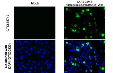 Anti-SARS-CoV-2 (COVID-19) Nucleocapsid antibody [HL455-MS] used in IHC-P (cell pellet) (IHC-P (cell pellet)). GTX635712