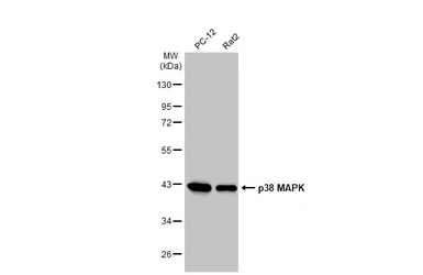 Anti-p38 MAPK antibody [HL1006] used in Western Blot (WB). GTX635797