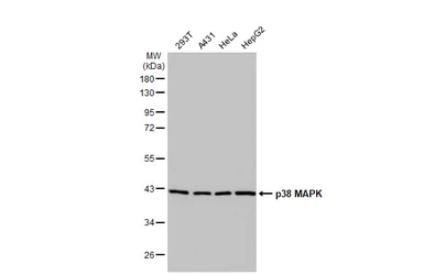 Anti-p38 MAPK antibody [HL1006] used in Western Blot (WB). GTX635797