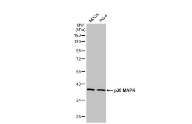 Anti-p38 MAPK antibody [HL1006] used in Western Blot (WB). GTX635797