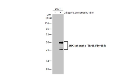 Anti-JNK (phospho Thr183/Tyr185) antibody [HL1008] used in Western Blot (WB). GTX635799