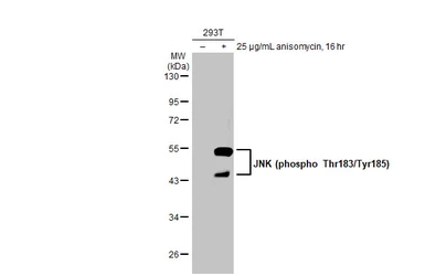 Anti-JNK (phospho Thr183/Tyr185) antibody [HL1008] used in Western Blot (WB). GTX635799