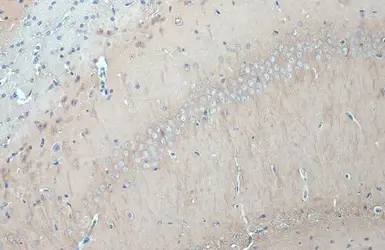 Anti-GSK3 beta antibody [GT16711] used in IHC (Paraffin sections) (IHC-P). GTX635816