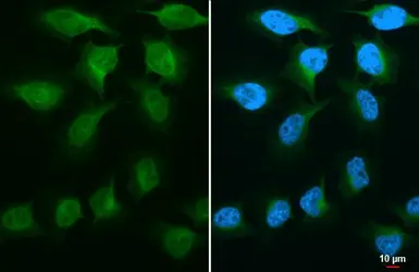 Anti-GSK3 beta antibody [GT16711] used in Immunocytochemistry/ Immunofluorescence (ICC/IF). GTX635816