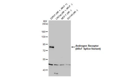 Anti-Androgen Receptor (ARv7 Splice Variant) antibody [HL1028] used in Western Blot (WB). GTX635842