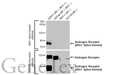 Anti-Androgen Receptor (ARv7 Splice Variant) antibody [HL1028] used in Western Blot (WB). GTX635842