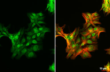 Anti-Androgen Receptor (ARv7 Splice Variant) antibody [HL1028] used in Immunocytochemistry/ Immunofluorescence (ICC/IF). GTX635842