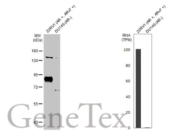 Anti-Androgen Receptor (ARv7 Splice Variant) antibody [HL1028] used in Western Blot (WB). GTX635842