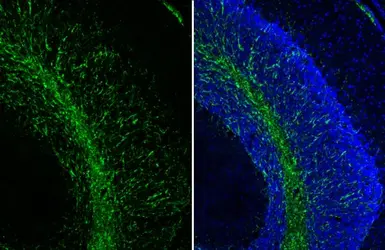 Anti-Myelin basic protein antibody [HL1033] used in IHC (Frozen sections) (IHC-Fr). GTX635873