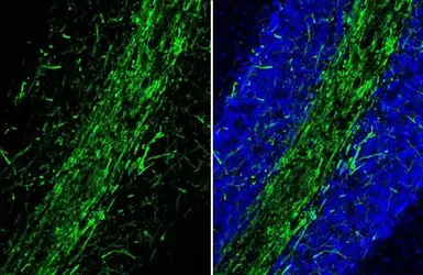 Anti-Myelin basic protein antibody [HL1033] used in IHC (Frozen sections) (IHC-Fr). GTX635873