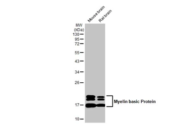 Anti-Myelin basic protein antibody [HL1033] used in Western Blot (WB). GTX635873