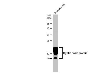 Anti-Myelin basic protein antibody [HL1033] used in Western Blot (WB). GTX635873