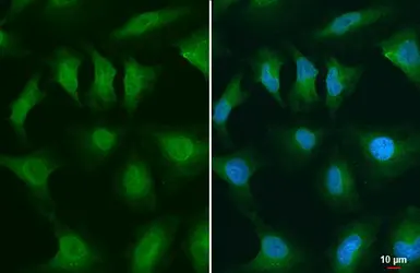 Anti-GSK3 beta antibody [GT1619] used in Immunocytochemistry/ Immunofluorescence (ICC/IF). GTX635886