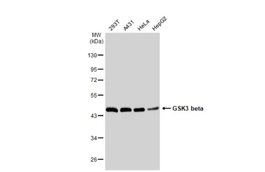 Anti-GSK3 beta antibody [GT1619] used in Western Blot (WB). GTX635886