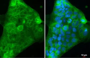 Anti-ACE2 antibody [GT19410] used in Immunocytochemistry/ Immunofluorescence (ICC/IF). GTX635897