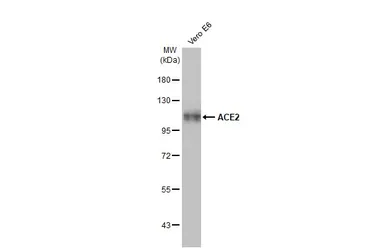 Anti-ACE2 antibody [GT19410] used in Western Blot (WB). GTX635897