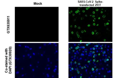 Anti-SARS-CoV-2 (COVID-19) Spike S2 / S2' antibody [HL1039] used in IHC-P (cell pellet) (IHC-P (cell pellet)). GTX635911