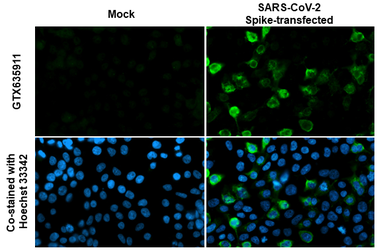 Anti-SARS-CoV-2 (COVID-19) Spike S2 / S2' antibody [HL1039] used in Immunocytochemistry/ Immunofluorescence (ICC/IF). GTX635911