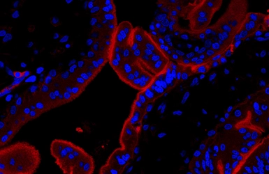 Anti-PD-L1 antibody [HL1041] used in IHC (Paraffin sections) (IHC-P). GTX635975