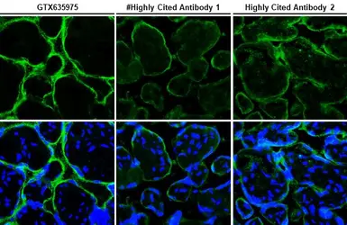 Anti-PD-L1 antibody [HL1041] used in IHC (Paraffin sections) (IHC-P). GTX635975