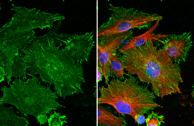 Anti-PD-L1 antibody [HL1041] used in Immunocytochemistry/ Immunofluorescence (ICC/IF). GTX635975