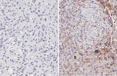 Anti-PD-L1 antibody [HL1041] used in IHC (Paraffin sections) (IHC-P). GTX635975