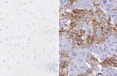 Anti-PD-L1 antibody [HL1041] used in IHC (Paraffin sections) (IHC-P). GTX635975