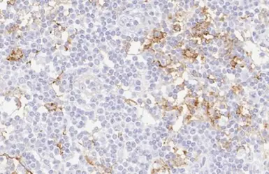 Anti-PD-L1 antibody [HL1041] used in IHC (Paraffin sections) (IHC-P). GTX635975