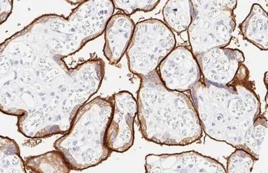 Anti-PD-L1 antibody [HL1041] used in IHC (Paraffin sections) (IHC-P). GTX635975