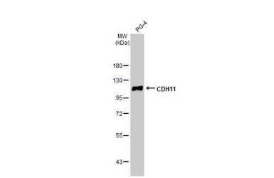 Anti-CDH11 antibody [HL1044] used in Western Blot (WB). GTX635978