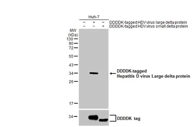 Anti-Hepatitis D virus Large delta protein antibody [HL1051] used in Western Blot (WB). GTX636026