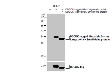 Anti-Hepatitis D virus Large delta + Small delta protein antibody [HL1053] used in Western Blot (WB). GTX636028