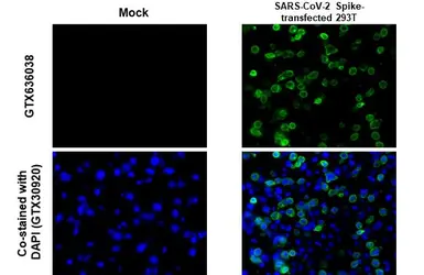 Anti-SARS-CoV-2 (COVID-19) Spike S2 antibody [GT8110] used in IHC-P (cell pellet) (IHC-P (cell pellet)). GTX636038