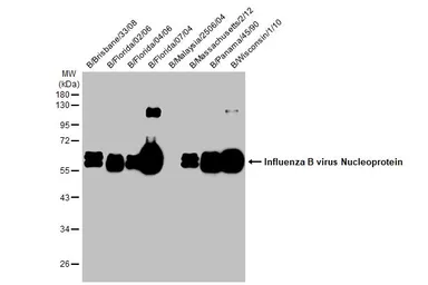 Anti-Influenza B virus Nucleoprotein antibody [HL1068] used in Western Blot (WB). GTX636099