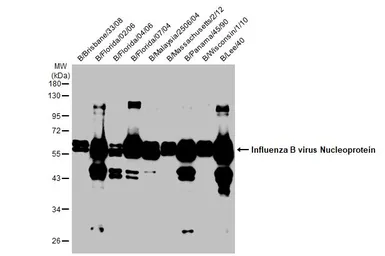 Anti-Influenza B virus Nucleoprotein antibody [HL1073] used in Western Blot (WB). GTX636194