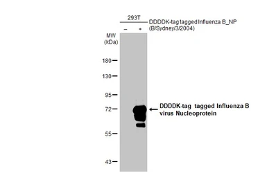 Anti-Influenza B virus Nucleoprotein antibody [HL1073] used in Western Blot (WB). GTX636194