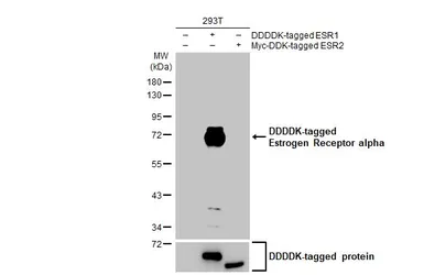 Anti-Estrogen Receptor alpha antibody [HL1081] used in Western Blot (WB). GTX636202