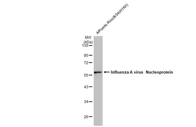 Anti-Influenza A virus Nucleoprotein antibody [HL1089] used in Western Blot (WB). GTX636247